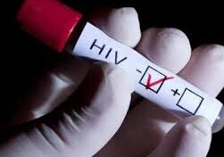Акции всеобщего тестирования на ВИЧ-в торговых центрах Баку