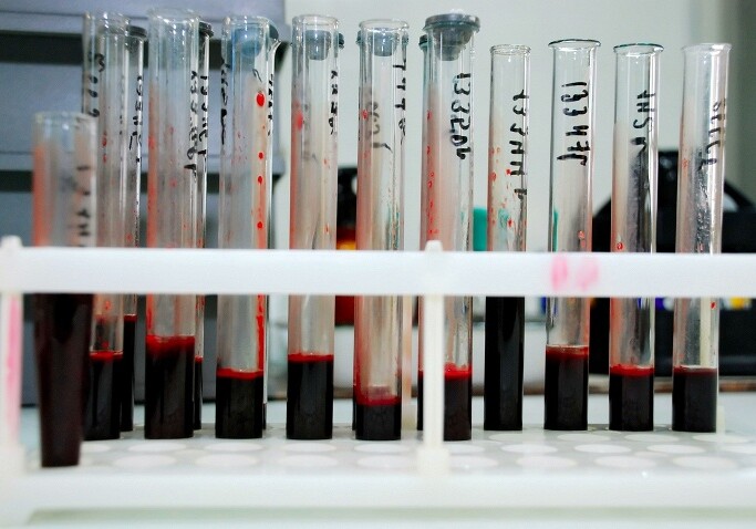 В крови излеченной от ВИЧ девочки вновь обнаружили следы вируса