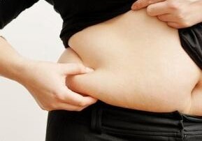 Примерно у трети женщин наблюдается лишний вес и ожирение-в Азербайджане 