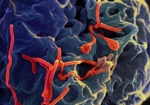 Японские ученые изобрели препарат, выявляющий вирус Эбола за 15 минут