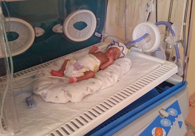 650-граммовый младенец выжил - в Азербайджане
