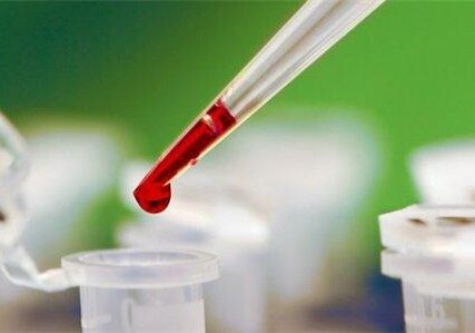 Создан тест, позволяющий по капле крови выявлять рак