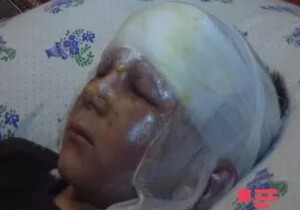 В Тертере взорвался боеприпас, ранен ребенок