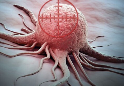 Ученые смогли увидеть, как «рождается» рак кожи