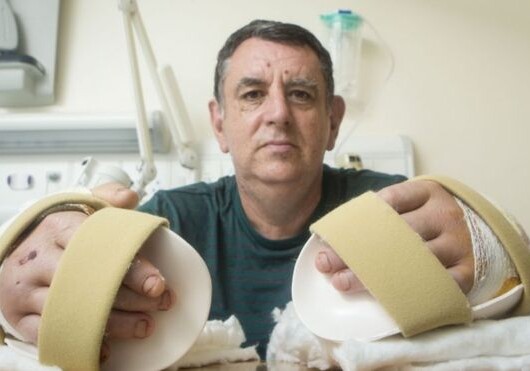 В Британии впервые проведена пересадка кистей обеих рук (Фото)