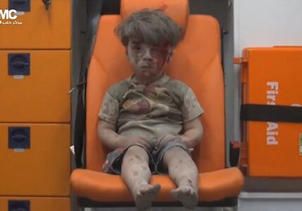Кадры с окровавленным мальчиком из Алеппо потрясли мир (Фото)
