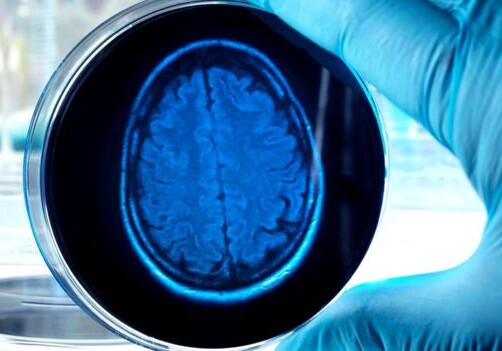 Как и зачем ученые выращивают человеческий мозг