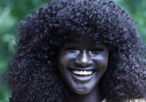 Уникальные люди с необычным цветом кожи (Фото)