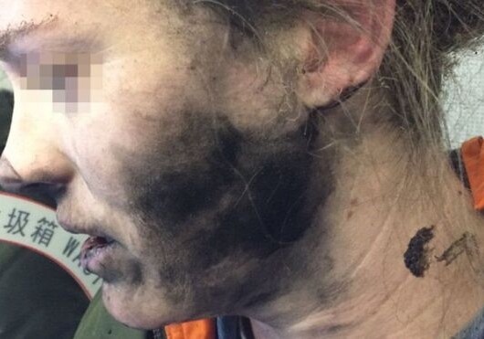 У летевшей в Мельбурн пассажирки взорвались наушники