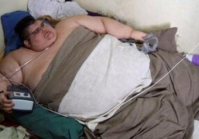 Самому толстому человеку в мире сделали операцию по шунтированию желудка (Фото)