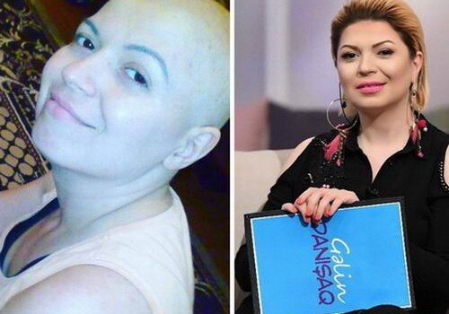 Актриса Зюмрюд Гасымова, победившая рак: «Мне хотелось перемотать мою жизнь, словно пленку …» (Фото) 
