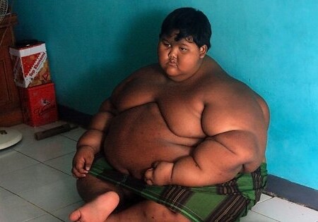 «Самый толстый в мире ребенок» за месяц сбросил 31 кг (Фото)