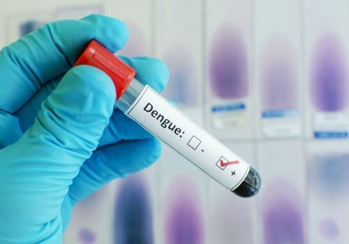 Есть ли вероятность распространения вируса Денге в Азербайджане?