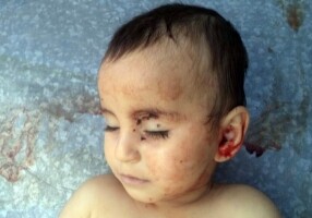 UNICEF выразила отношение к убийству армянами 2-летней Захры