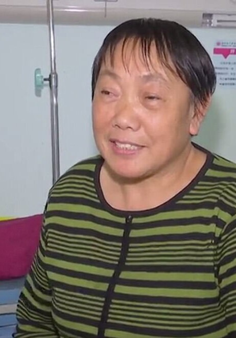 Жительнице Китая удалили выросший в носу зуб (Фото-Видео)