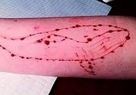 «Синий кит» уже в Баку: ученики бакинской школы нанесли себе порезы