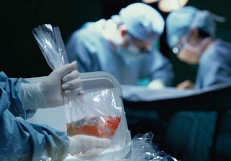 Разрабатывается концепция трансплантации органов умершего человека - в Азербайджане
