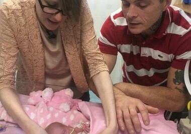 Британские врачи спасли новорожденную, которая родилась с сердцем вне тела (Фото)
