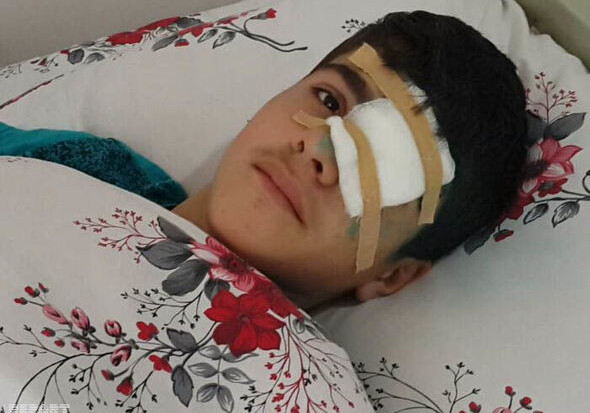 На Абшероне школьник получил ранение в глаз (Фото)