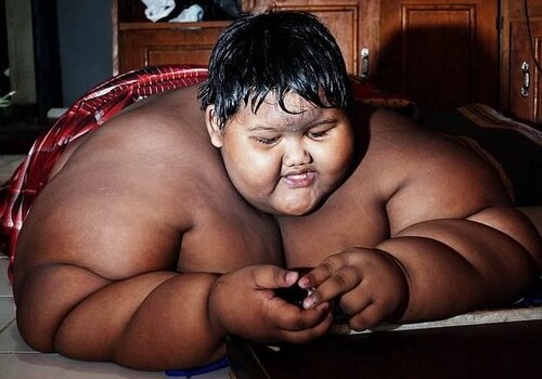 Самый толстый мальчик в мире похудел на 80 килограммов (Фото)