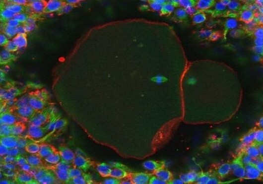 Ученые впервые вырастили человеческую яйцеклетку в лаборатории