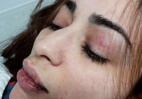 В Москве пьяный «гаишник» избил азербайджанку на глазах ее ребенка (Фото)