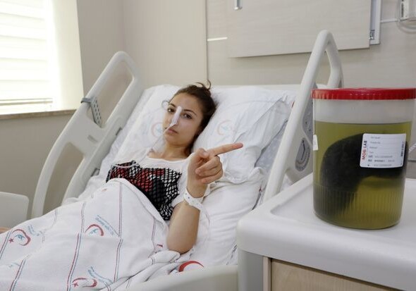 Содержимое желудка девушки повергло в шок врачей (Фото)