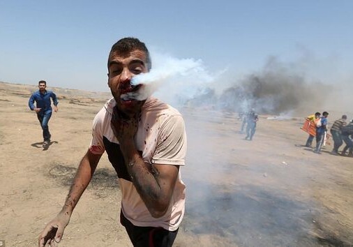 Израильская граната с газом попала палестинцу за щеку (Фото)