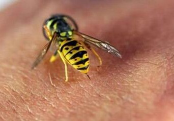 В Товузе женщина скончалась после укуса пчелы