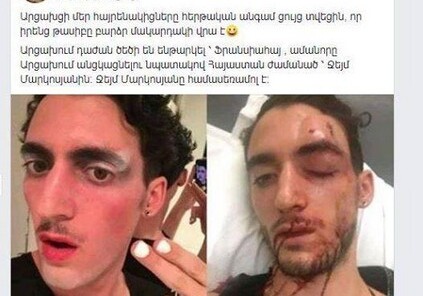 В Карабахе избили представителя секс-меньшинств из Франции – Сепаратисты спешно оправдываются