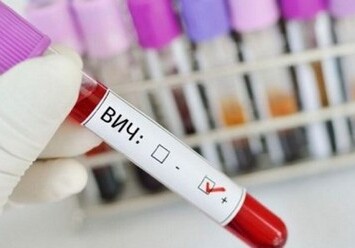 Найден способ полностью остановить распространение ВИЧ