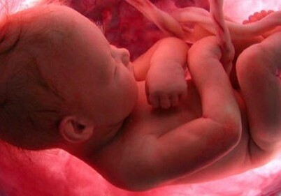 Чешские врачи смогли вырастить ребенка в утробе умершей матери