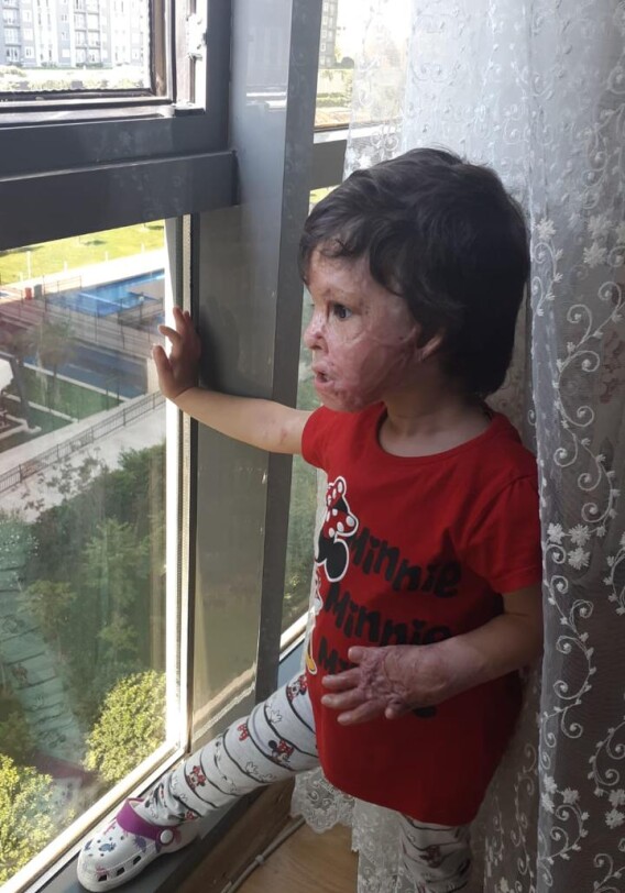 Маленькая Анжела продолжила лечение в Стамбуле (Фото-Видео)