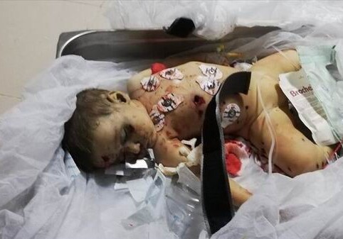 9-месячный ребенок стал жертвой террористов РКК (Фото)