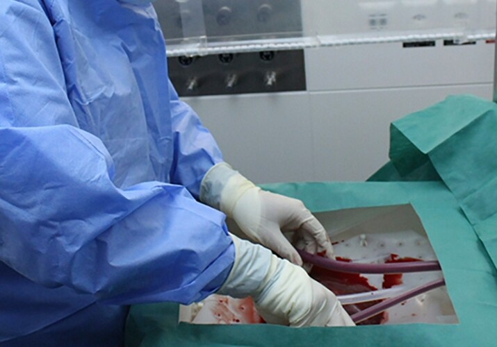 Совершен прорыв в хранении донорских органов вне тела
