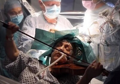 Англичанка играла на скрипке во время операции на мозге (Видео)