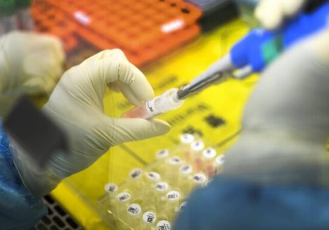Японская компания начнет продавать тесты для выявления коронавируса за 15 минут