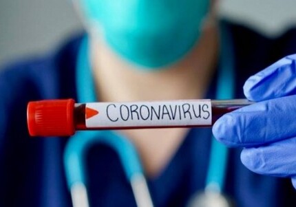 Число инфицированных COVID-19 в Армении увеличилось до 64