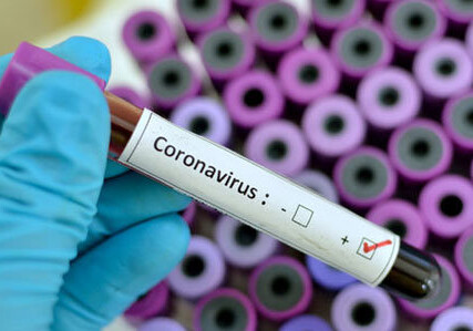 Новый коронавирус пришел в человечество навсегда – Ученый