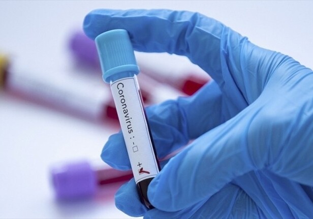 В Азербайджане выявлено 76 новых случаев заражения коронавирусом, 1 человек умер