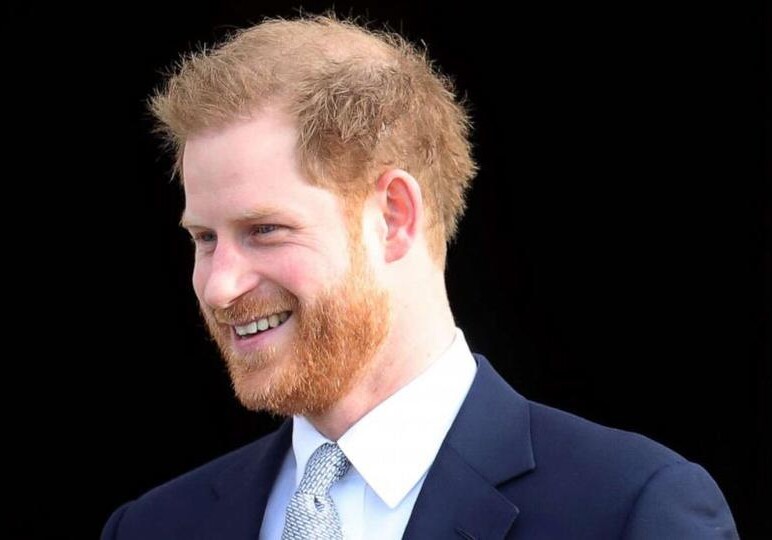 Британский принц Гарри пересадил волосы - СМИ