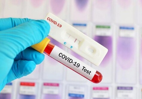 Американские ученые создали тест для раннего выявления COVID-19