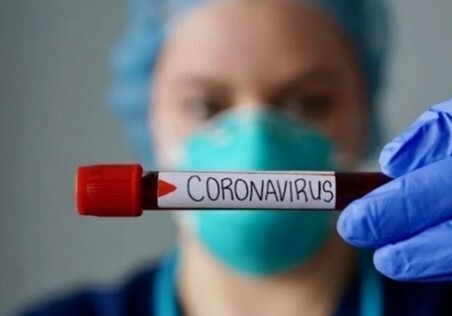 Число выявленных случаев заражения коронавирусом в Армении увеличилось до 3538
