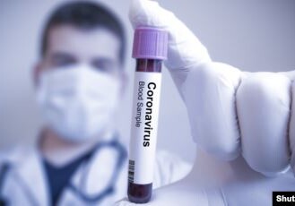 В Армении зафиксировано уже 9492 случая коронавируса