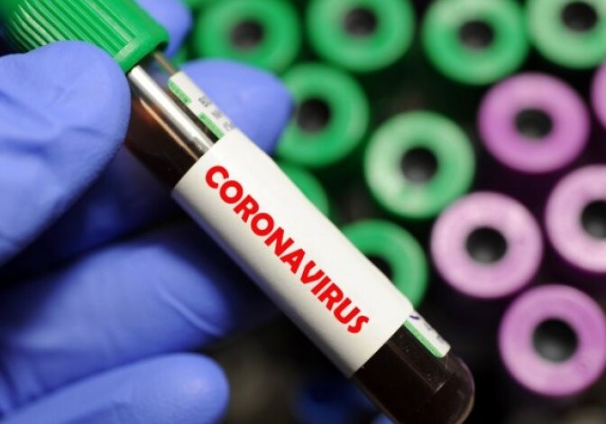 В Сумгайыте сотрудник одного из маркетов заразился коронавирусом - Более 40 человек помещены на карантин (Видео)