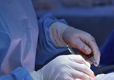 Болгарские врачи изъяли из желудка мужчины полкило железных приборов