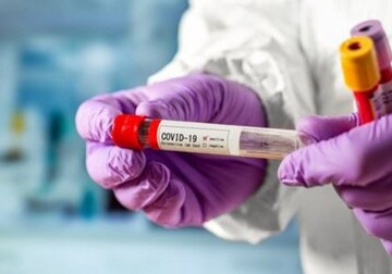Zeytun Pharmaceuticals безвозмездно передала Минздраву 50 тыс. наборов тестов для диагностики COVID-19