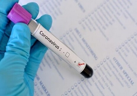 У двух сотрудников Милли Меджлиса выявлен коронавирус