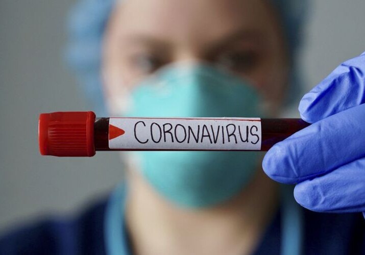 В Азербайджане выявлен 471 новый случай инфицирования коронавирусом (Фото)