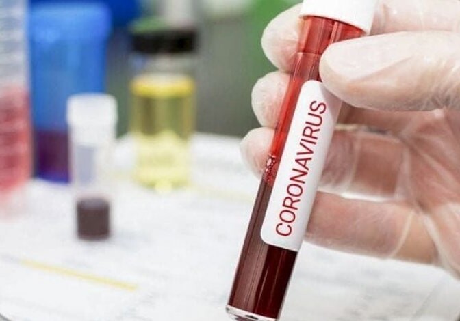 В Азербайджане выявлено еще 84 случая заражения коронавирусом
